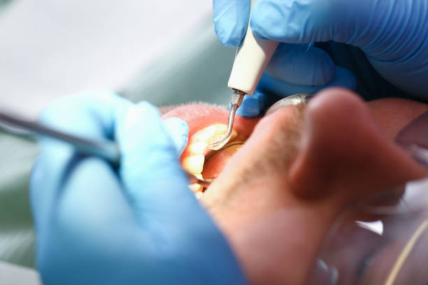 Best Pediatric Emergency Dentist in San Buenaventura, CA