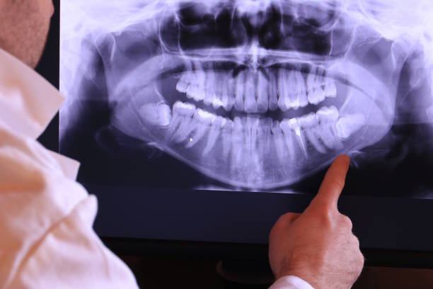 Best Same-Day Emergency Dentist in San Buenaventura, CA